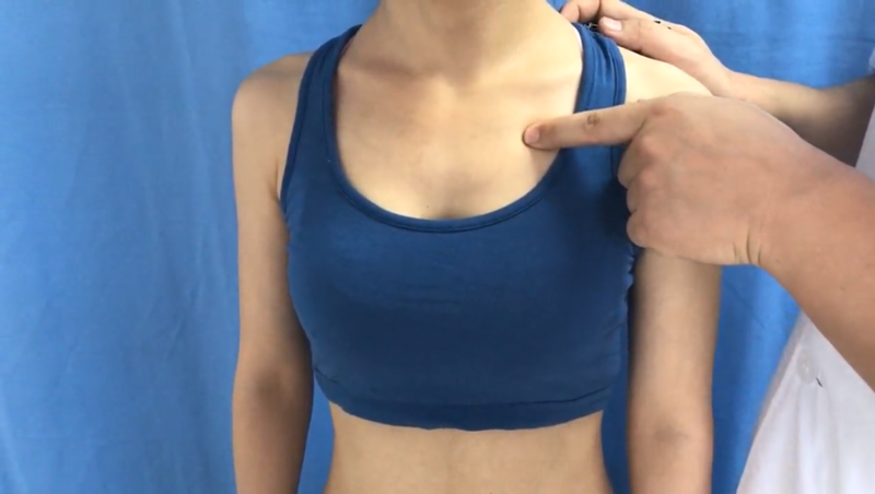 屋翳穴 / ST-15 / Wuyi / Roof Screen / Canopy Cover