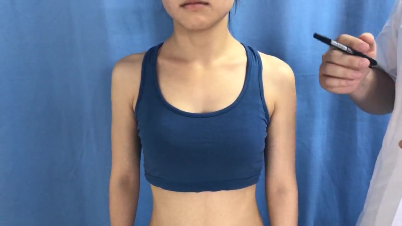 乳中穴 /  ST-17 / Ruzhong / Middle of the Breast / Nipple Center