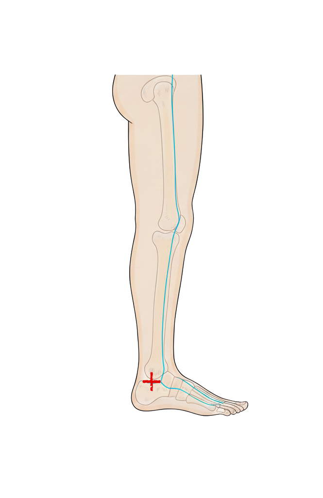 太溪穴 / KID-3 / Taixi / Great Stream