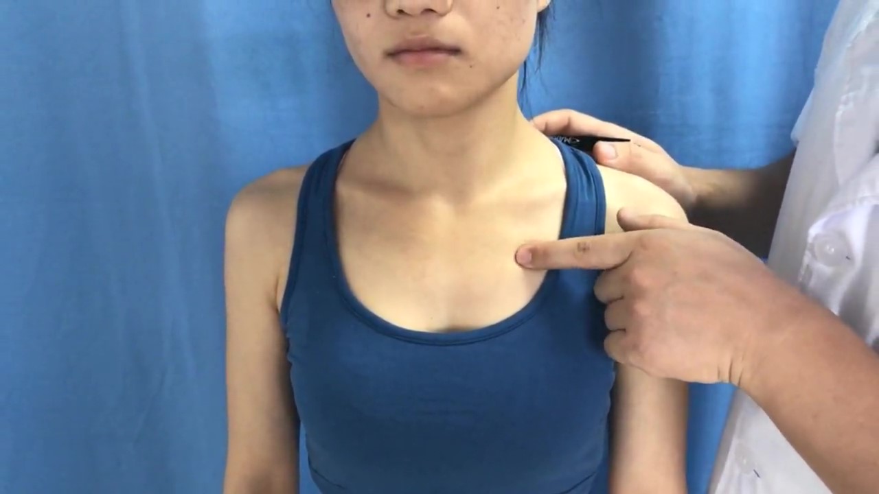 膺窗穴 / ST-16 /Yingchuang / Chest Window / Window of the Chest